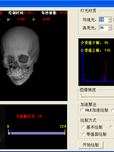 基于VTK的三维医学图像可视化处理系统