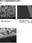 新型胆管仿生支架的实验研究